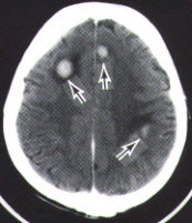 Figure 1, left