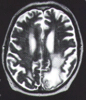 Figure 1, center