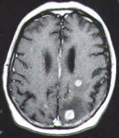 Figure 1, right